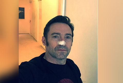 Hugh Jackman es operado por sexta ocasión de cáncer de piel