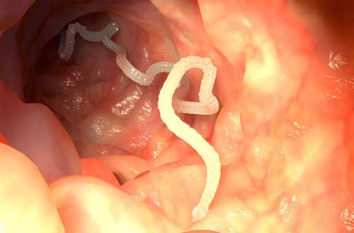 Parasitosis afecta principalmente a niños y adultos mayores: Especialistas