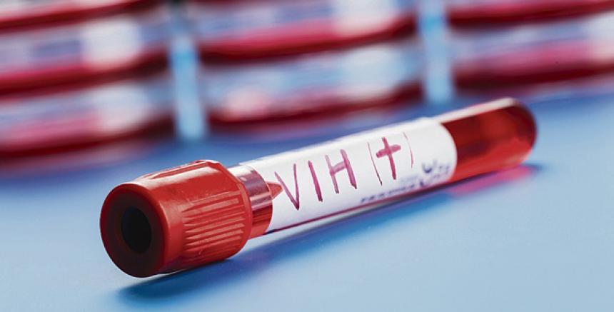 Ya está lista la vacuna contra el VIH