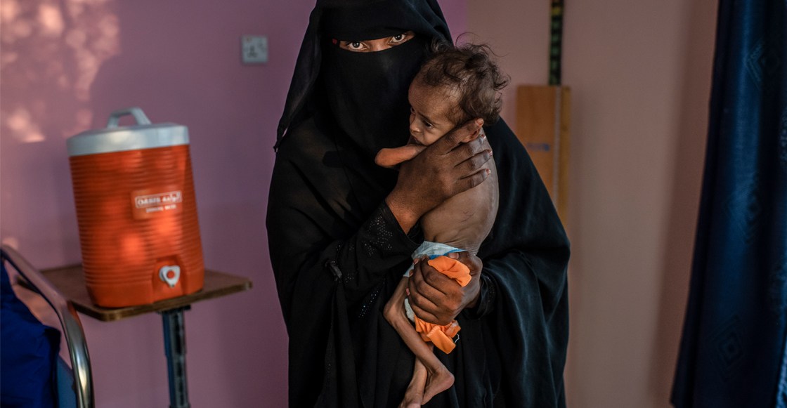 Por guerra en Yemen, unos 85 mil niños han muerto de hambre