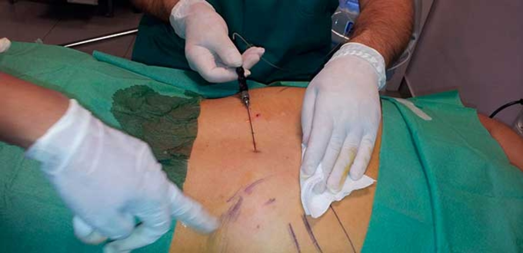 México, uno de los países con mayor práctica de cirugías estéticas