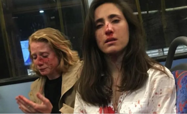 Una pareja de mujeres sufre un violento ataque homofóbico en Londres