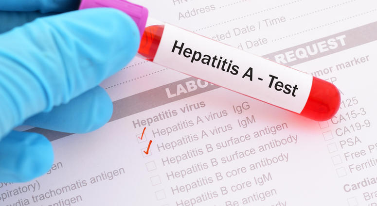 Hay emergencia de salud pública en Florida por brote de Hepatitis A