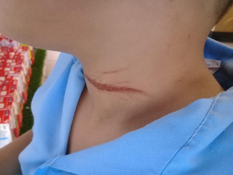 Madre denuncia que un niño cortó el cuello de su hijo en una escuela de Veracruz