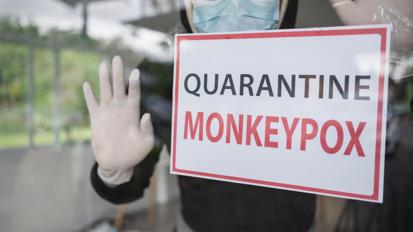 Declaran estado de emergencia por viruela del mono en Illinois, California y Nueva York