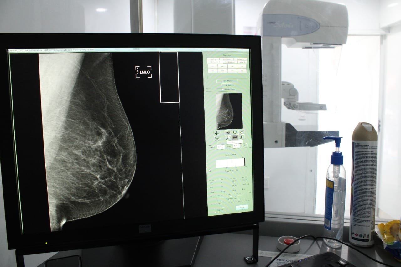 Secretaría de Salud de la CDMX realizará jornada de mastografías gratuitas