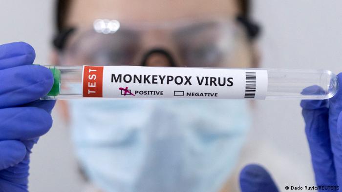 OMS renombra a la viruela del mono: ahora se llama ‘mpox