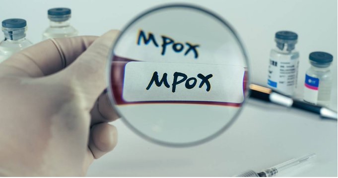 Se cumple un año del primer caso de mpox en Jalisco