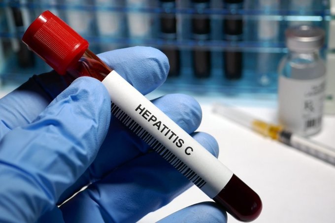 Hepatitis C puede ser curable en dos meses: Censida