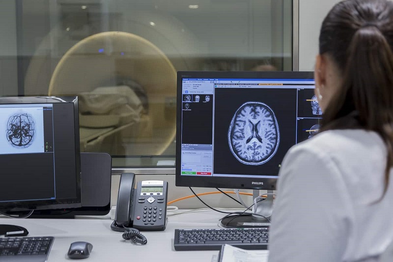 La enfermedad vascular cerebral es la séptima causa de decesos en México; puede prevenirse con cambios en estilo de vida y control de enfermedades crónicas