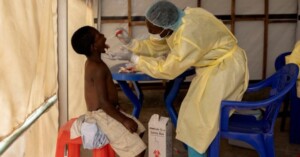 África declara "urgencia" sanitaria por epidemia de mpox