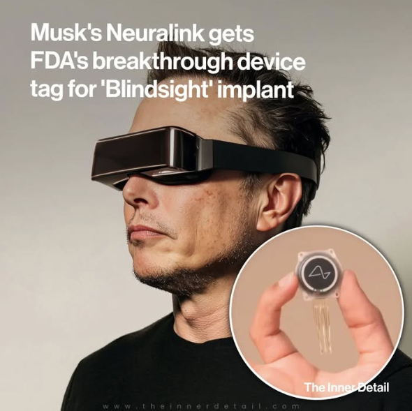 Blindsight, el dispositivo cerebral que podría devolver la vista