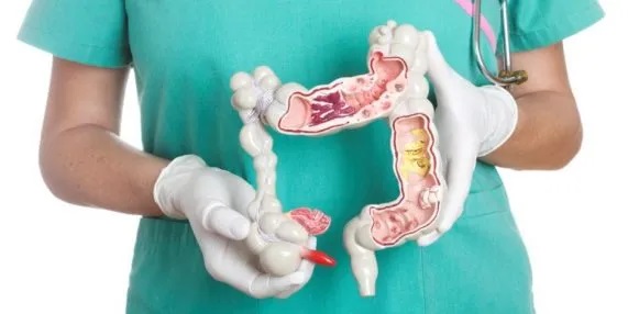 Señales de advertencia del cáncer de colon que no debes ignorar